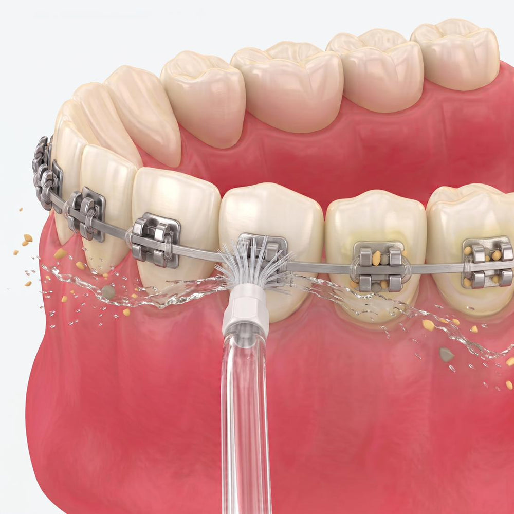 reboot R01 orthodontic tip cleaning around a bracket and under the archwire, removing plaque and food debris from braces